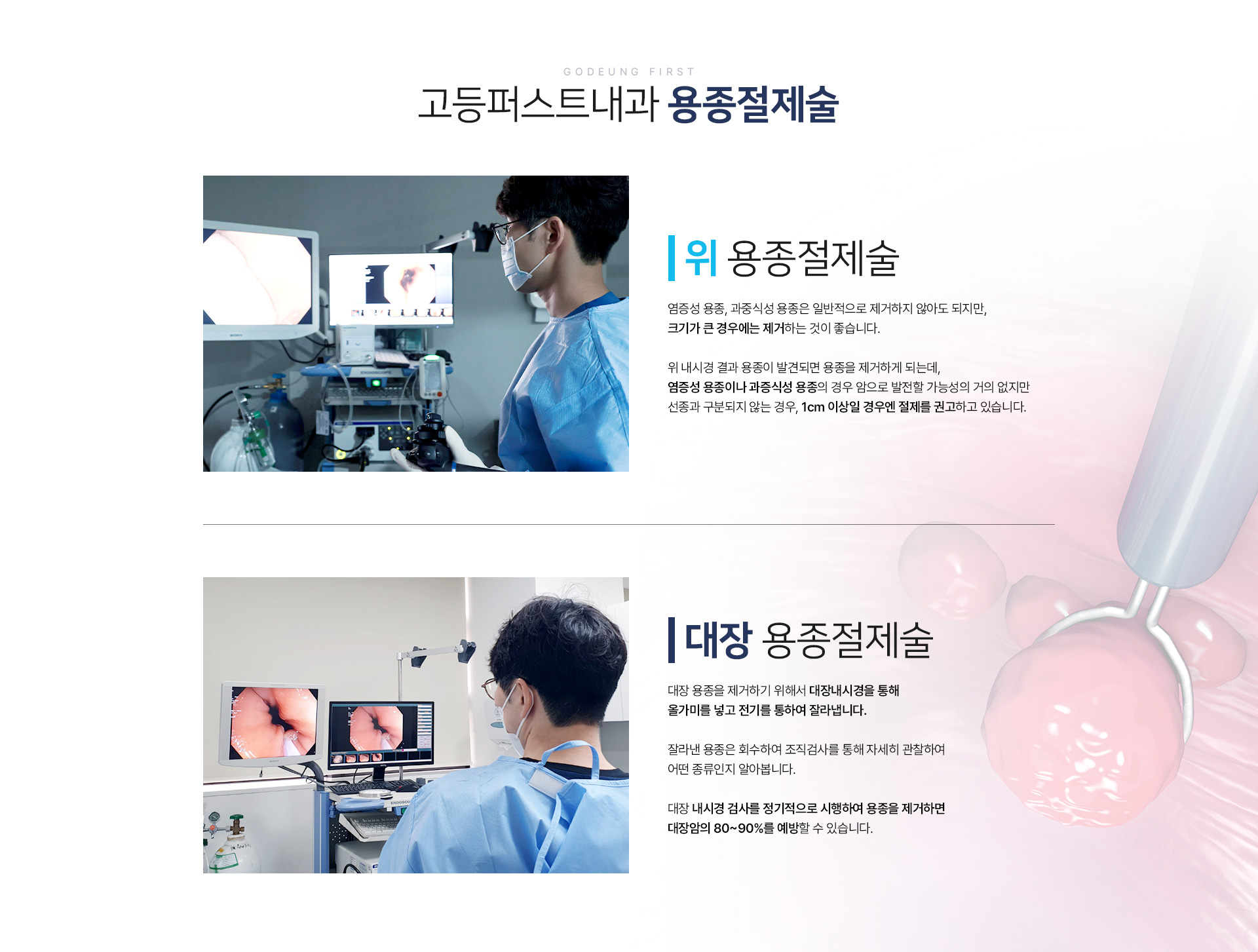용종절제술 종류